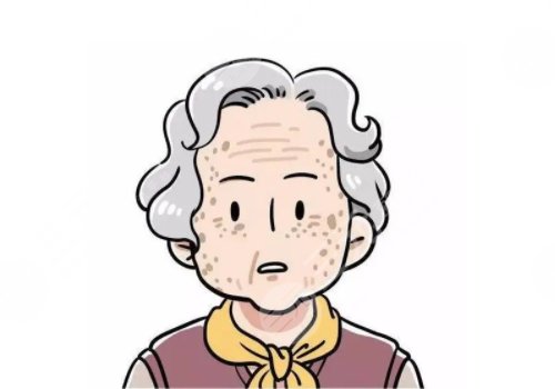 怎样治老年斑？