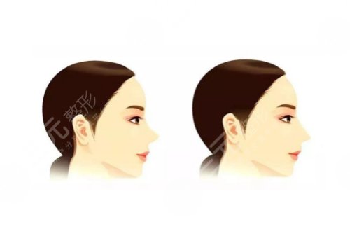 承德玥莱美医疗美容医院怎么样?