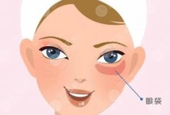 眼袋和黑眼圈的区别对比，图文讲解！显老还是这俩狠啊！