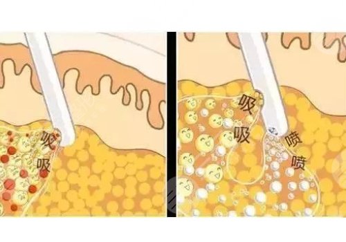 武汉小忠丽格医疗美容怎么样?
