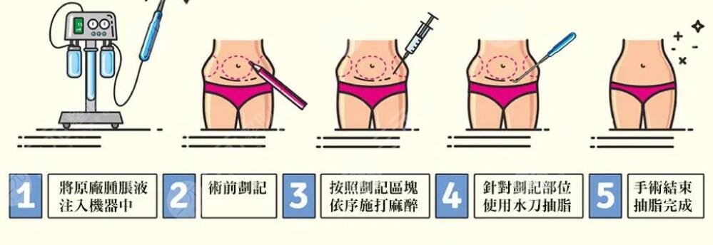 不吃药的减肥方法1周瘦10斤怎么减?