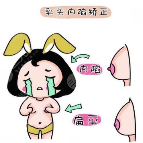 乳头内陷需要注意的事项有什么?