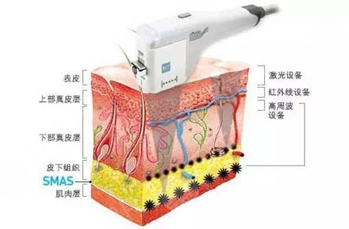 脸上的红血丝是怎么造成的?