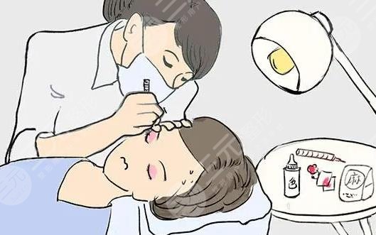 iu整容整哪里了?