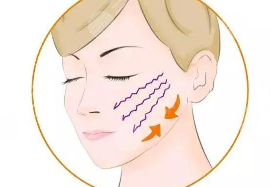 iu整容整哪里了?