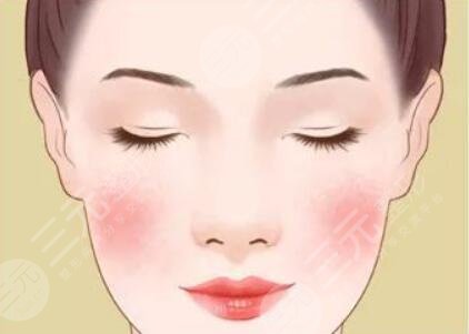 脸上的红血丝怎么去掉?