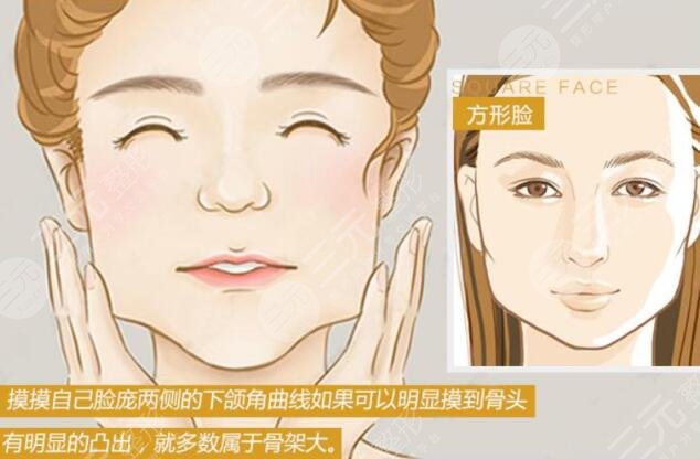 下颌角长曲线截骨术价格多少?