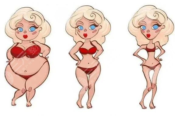 等离子激光溶脂果如何？是减脂黑科技？还是噱头而已？