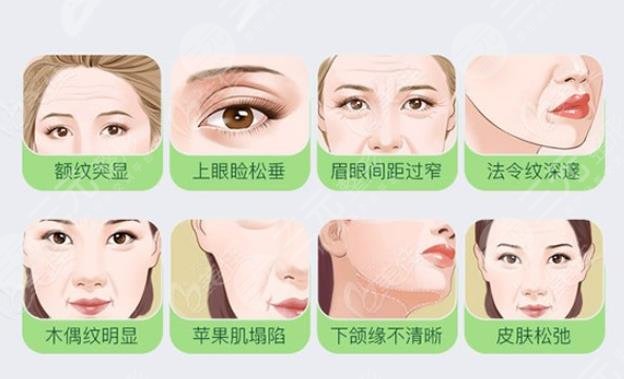 大拉皮除皱手术后可维持多少年