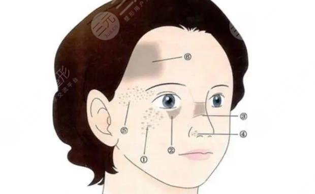 苏州祛胎记多少钱?