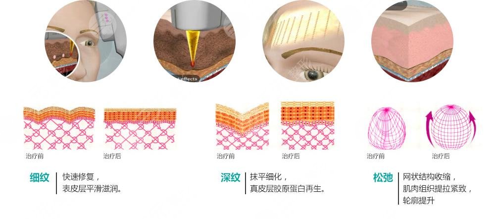 彩光祛痘果怎么样?