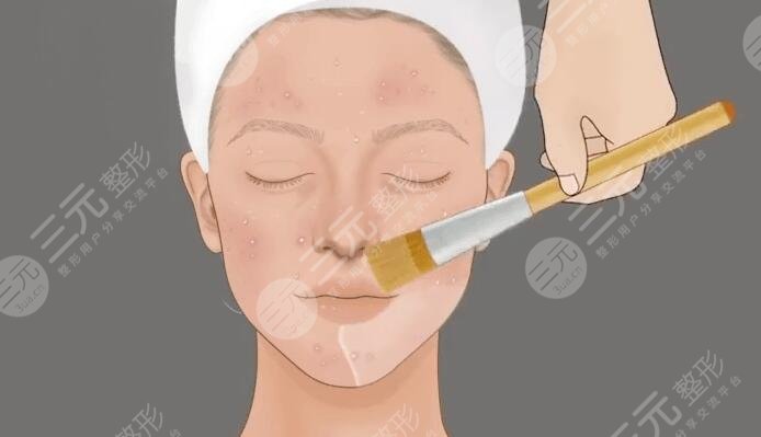 芯丝翠果酸换肤的果图来袭！具体缓解功有哪些？美肤人必看系列！