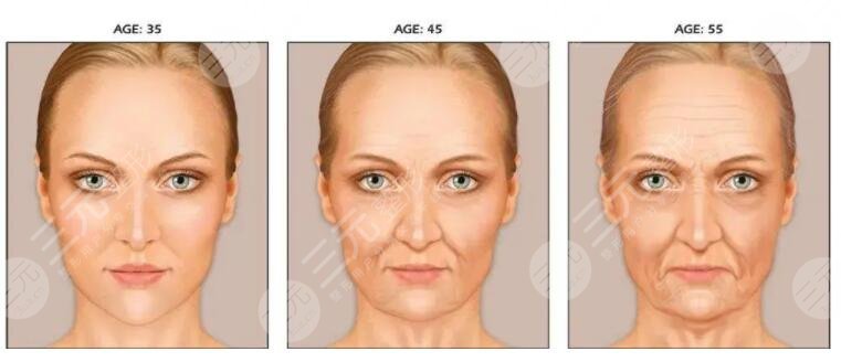 面部下垂提升术多少钱