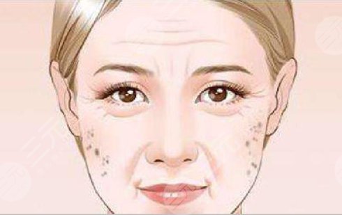 #偏方大全#怎样治老年斑?