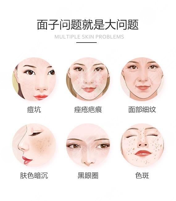 像素激光祛痘坑?果怎么样?