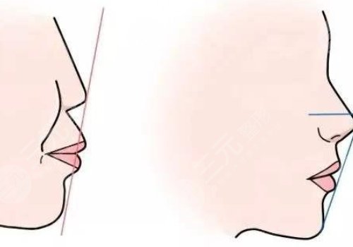 西安金长鑫做鼻子怎么样?