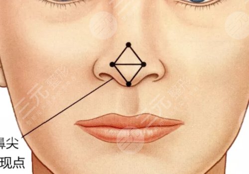 西安金长鑫做鼻子怎么样?