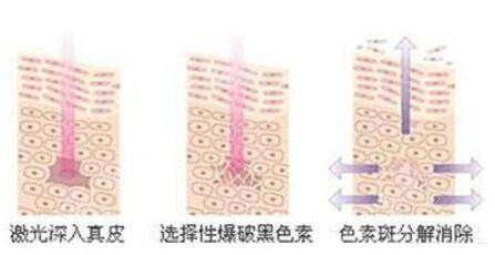 黑脸娃娃要做几次才看得到果?