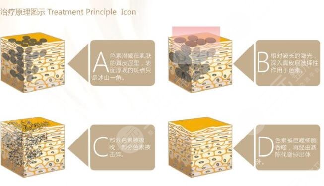 黑脸娃娃的适用人群