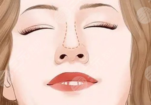怎么让鼻头变小？