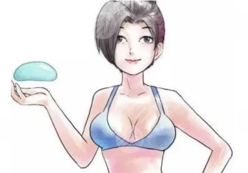 假体隆胸术有哪些特点?