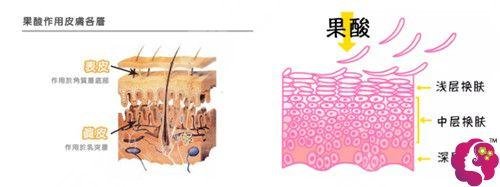 果酸换肤要做几次才有果?