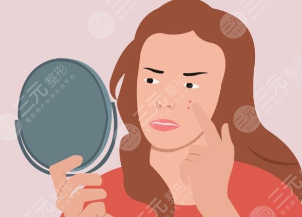 北京缓解痤疮多少钱一个疗程？针对脸上的坑坑洼洼,适合成年人长痘的方法！