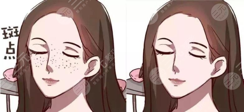 皮肤上的色斑是如何形成的?