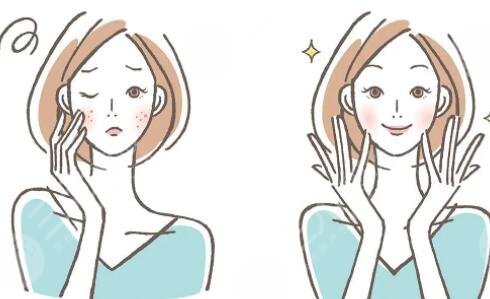 市面上常见祛斑方法