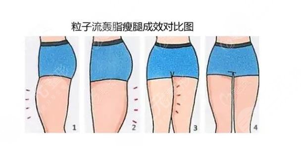 瘦腿袜真能瘦腿吗?