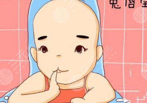 缓解兔唇的费用大概是多少?