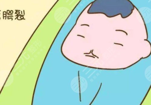 缓解兔唇的费用大概是多少?