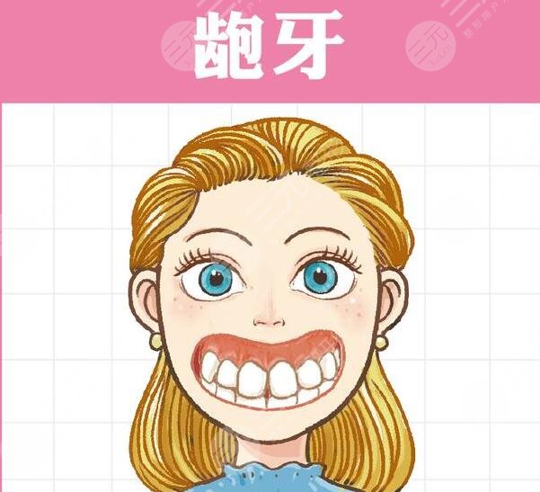 美容冠矫正龅牙果吗?其实这种缓解能够让口腔状态更加地正常和协调,而且也能够让牙齿排列的,更加的精美。通过做龅牙的矫正缓解,能够让整个人的口腔状态看上去更加的自然和协调,但是想要通过做美容冠来解决自己的龅牙,这种做法是不推荐的,虽然能够达到一定的果,但是治标不治本,而且,这种缓解方式,并不适用于所有的龅牙。那么,美容冠矫正龅牙果如何? 一、美容冠矫正龅牙果吗? 一般情况下,如果龅牙的程度比较轻的话,那么通过做美容冠缓解能够达到一定的果,但是严重的龅牙,做美容冠其实是没有作用的,不能够达到龅牙的缓解果。有些轻度的龅牙,做美容冠是有代价的,而且需要在专业医生的指导下磨出一部分牙齿组织,让牙齿变得更小,然后重新套一个冠下去,并且,套一个可能没那么龅的固定冠下去,所以说这种方式有一定的局限性,而且是不值得推荐的。 二、龅牙如何缓解? 龅牙的缓解方式主要分为拔牙和牙齿矫正,尤其是隐形正畸手术或金属正畸手术。有龅牙的求美者,建议去做正畸缓解,通过做该缓解,能够让牙齿排列的更加的正。或者如果严重,还可以去专业的医院完成正颌外科方面的手术,包括联合箍牙、矫牙的缓解来进行矫正。 1、做拔牙缓解。其实拔牙缓解能够让整个人的口腔状态看上去更加的美观,而且拔出了大多数的牙齿之后,整个人的口腔状态也会更加的协调龅牙的存在,也能够得到更好的改良。 2、做牙齿矫正手术。做牙齿矫正手术,包括隐形正畸手术和金属正畸手术,而且需要佩戴牙套,再佩戴了牙套之后牙齿才会排列的,更加的整齐和美观。一般分为隐形的牙套和金属的牙套,隐形的牙套是可以自行摘戴的,而且美观都是相对较好的,虽然金属牙套不能够自行摘戴,但是能够起到更好的塑形果,其实也是一种不错的操作。在佩戴牙套大概一年左右的时间再取下来,整个人的口腔状态看上去就会更加的美观,并且牙齿也会更加的自然和协调,一般不会出现剧烈的刺痛感和疼痛感,但是需要对口腔进行一定的护理。 3、做正颌手术。做任何手术能够让牙齿排列的更加的整齐,也能够让整个人的牙槽骨看上去更加的自然和协调,做完缓解之后牙齿是一般不会脱落的。 三、美容冠矫正龅牙的注意事项 其实,做牙齿方面的缓解一定要找专业的医生进行操作,不能够盲目的开展缓解。而且做完缓解之后,也要多吃新鲜的蔬菜和水果,少吃辛辣油腻以及刺激性的食物,不能够经常熬夜,否则可能会影响自己牙齿的恢复。同时也要注重自己日常的口腔清洁和护理,如果出现了牙菌斑滋生的现象,那么就要找医生进行一定的缓解,不能够经常不刷牙,否则可能会导致牙齿细菌增多影响口腔的健康。