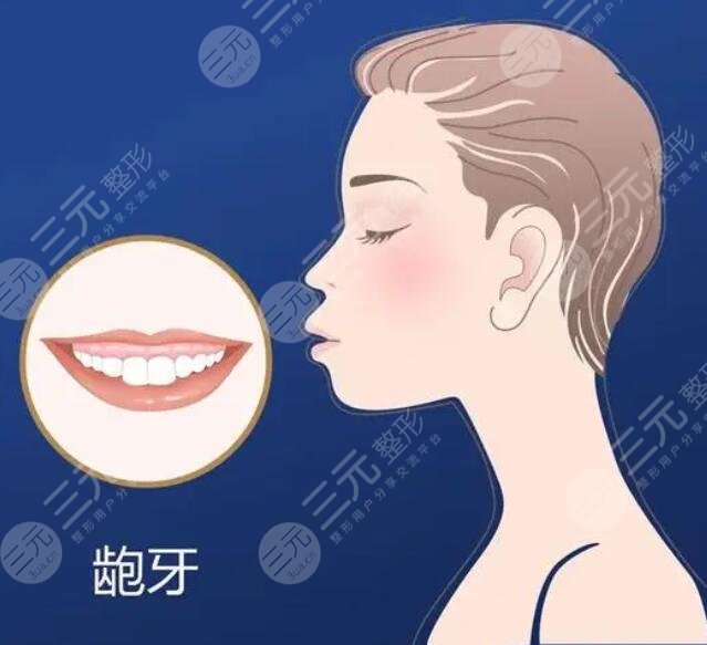 龅牙如何缓解?