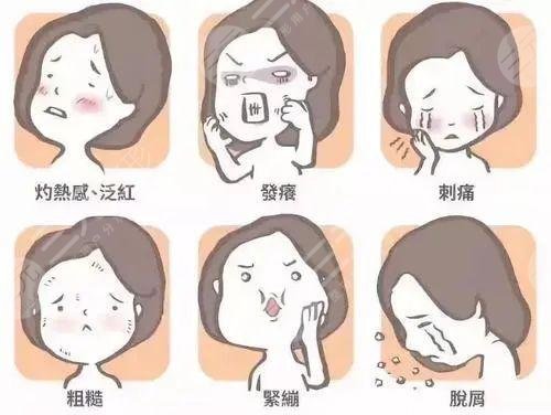 缓解痤疮的较佳方法