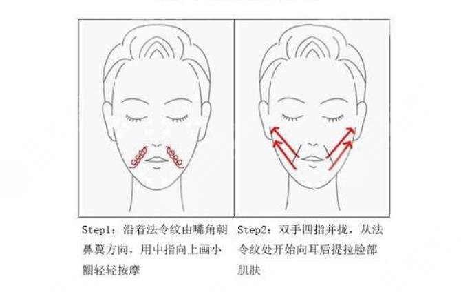 玻尿酸去法令纹需?要多少钱?