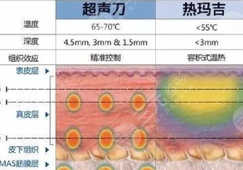 热玛吉和超声炮一起做好还是分开做好