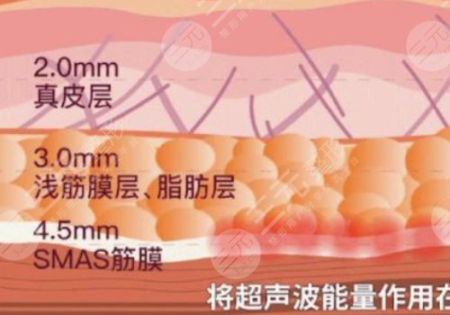 热玛吉和超声炮一起做好还是分开做好?