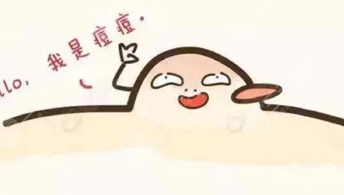 光动力激光缓解痤疮好不好呢?