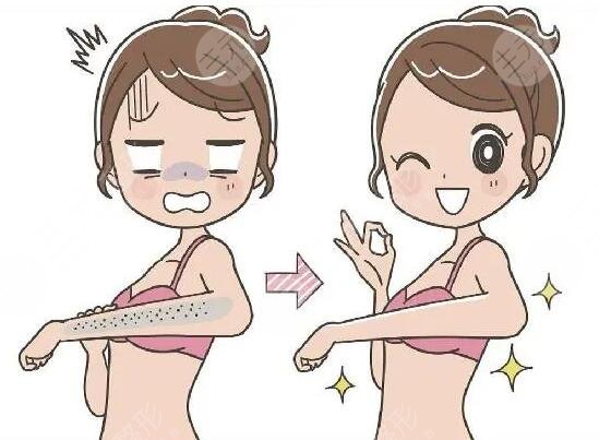 北京全身脱毛大概需要多少钱?