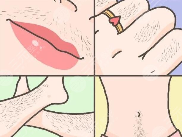 北京全身脱毛的注意事项