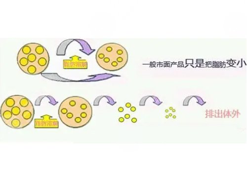 做了镭射溶脂之后需要注意什么?