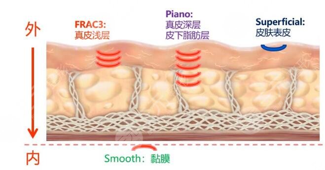 脸部吸脂的价格影响因素有哪些？