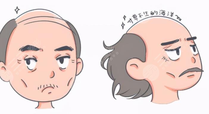 生姜能缓解脱发吗?怎么正确使用不伤头皮?详细操作方法告诉你!