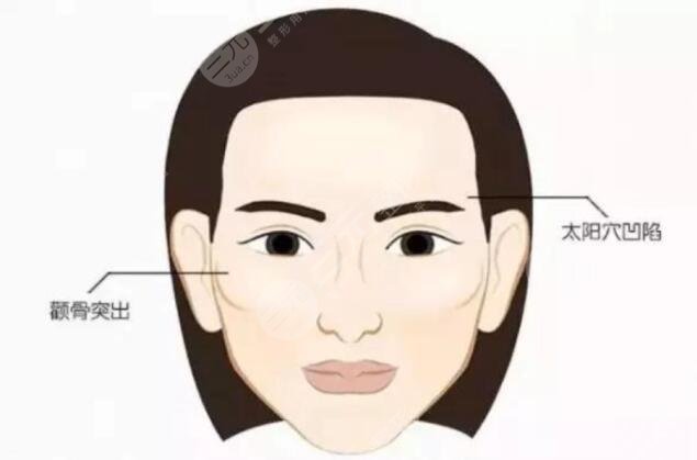 丰太阳穴的方法都有哪些呢?