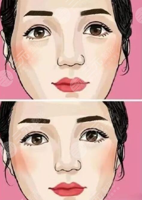 丰太阳穴的方法都有哪些呢?