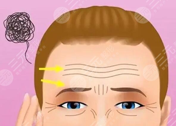 怎么样去掉抬头纹有效的小妙招!提醒您这几种方式有效!网友们都爱!