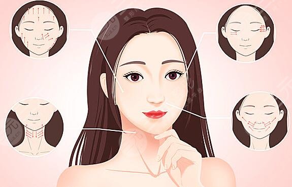 怎么样去掉抬头纹?