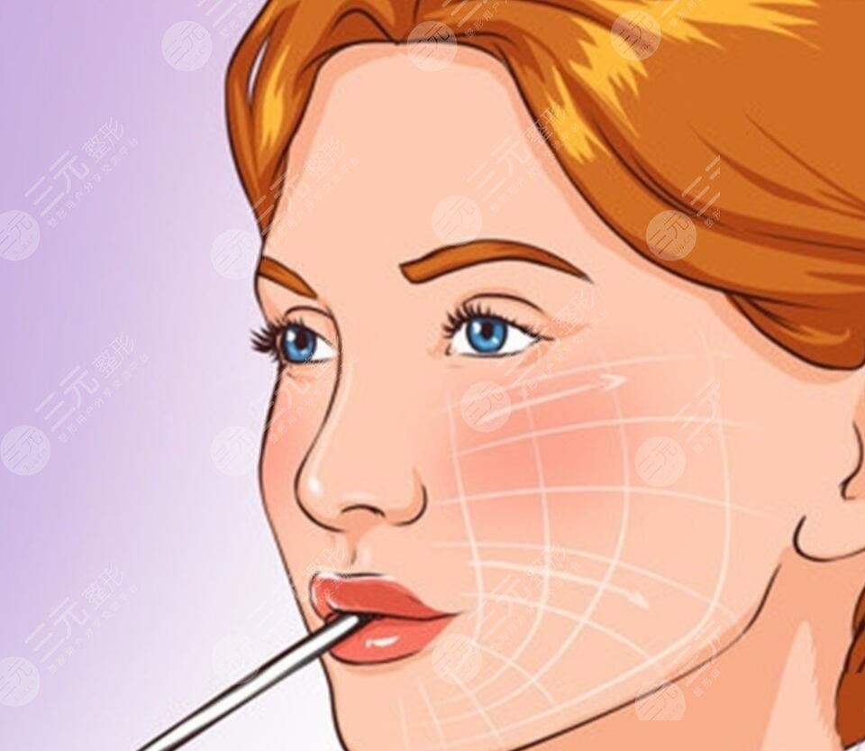 去掉抬头纹的注意事项