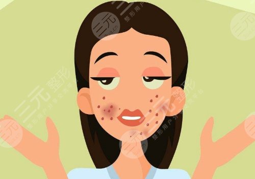 激光祛痘坑痘印有没有危害?